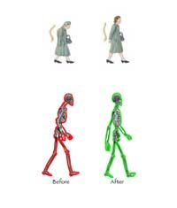 Examples of good and poor walking postures
