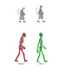 Examples of good and poor walking postures Examples of good and poor walking postures